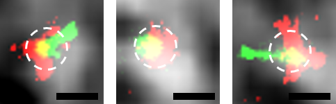 Tau (red), a protein involved in Alzheimer’s disease, co-localises with vesicular markers (green), informing us on the fate of Tau after internalisation by primary neurons in culture. The typical size of a vesicle is indicated by the white dashed lines. S